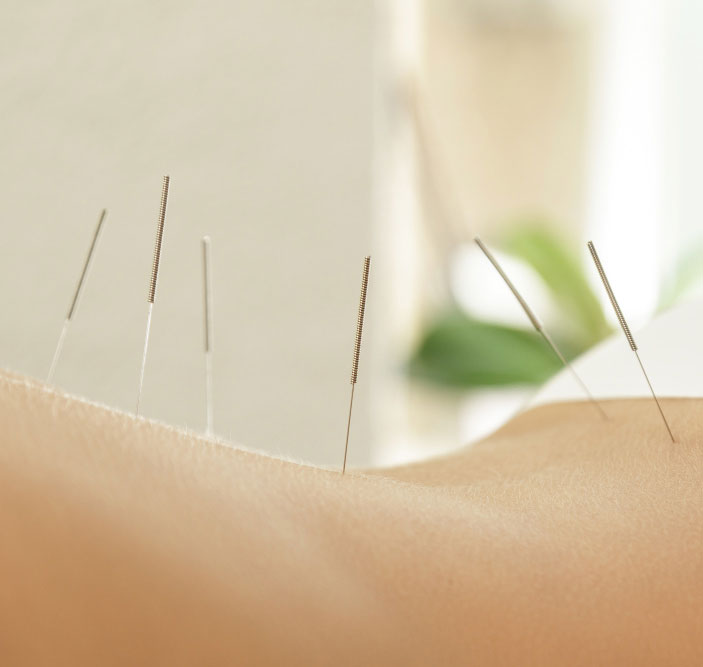 Akupunktúra kezelés - Akupunktúra Budapest - Dr. Teng